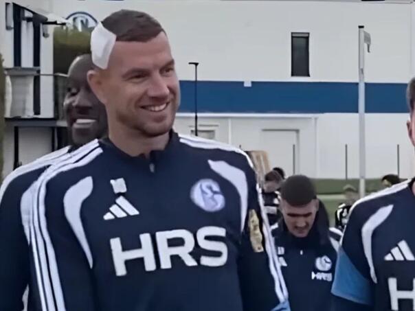 Džeko trenirao s flasterom na glavi, Muslić dobio i dobre i loše vijesti pred Köln